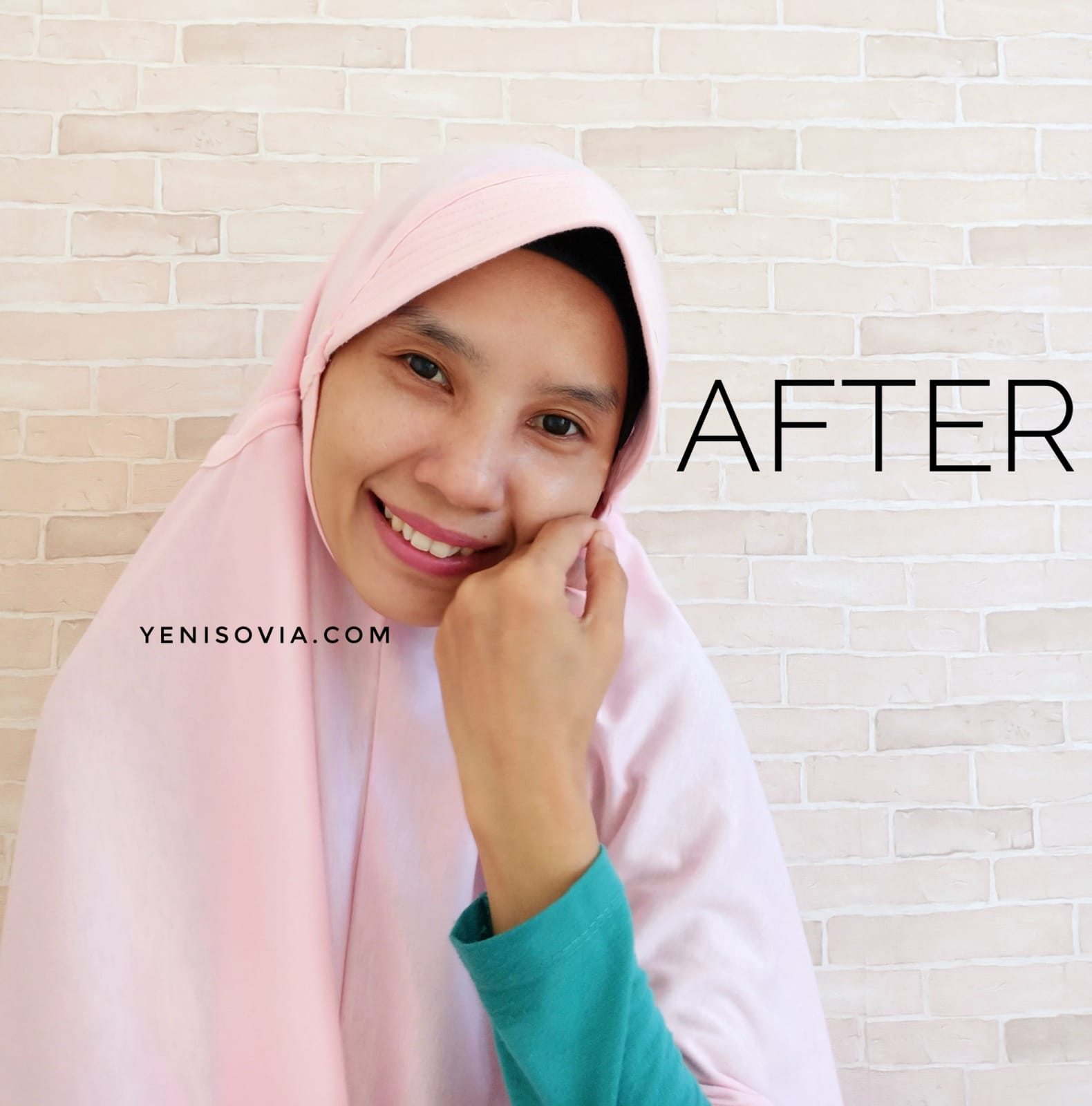 Percaya Diri dengan Skincare Ibu Hamil dan Menyusui yang Aman Skincare aman untuk ibu hamil dan menyusui Mama's Choice