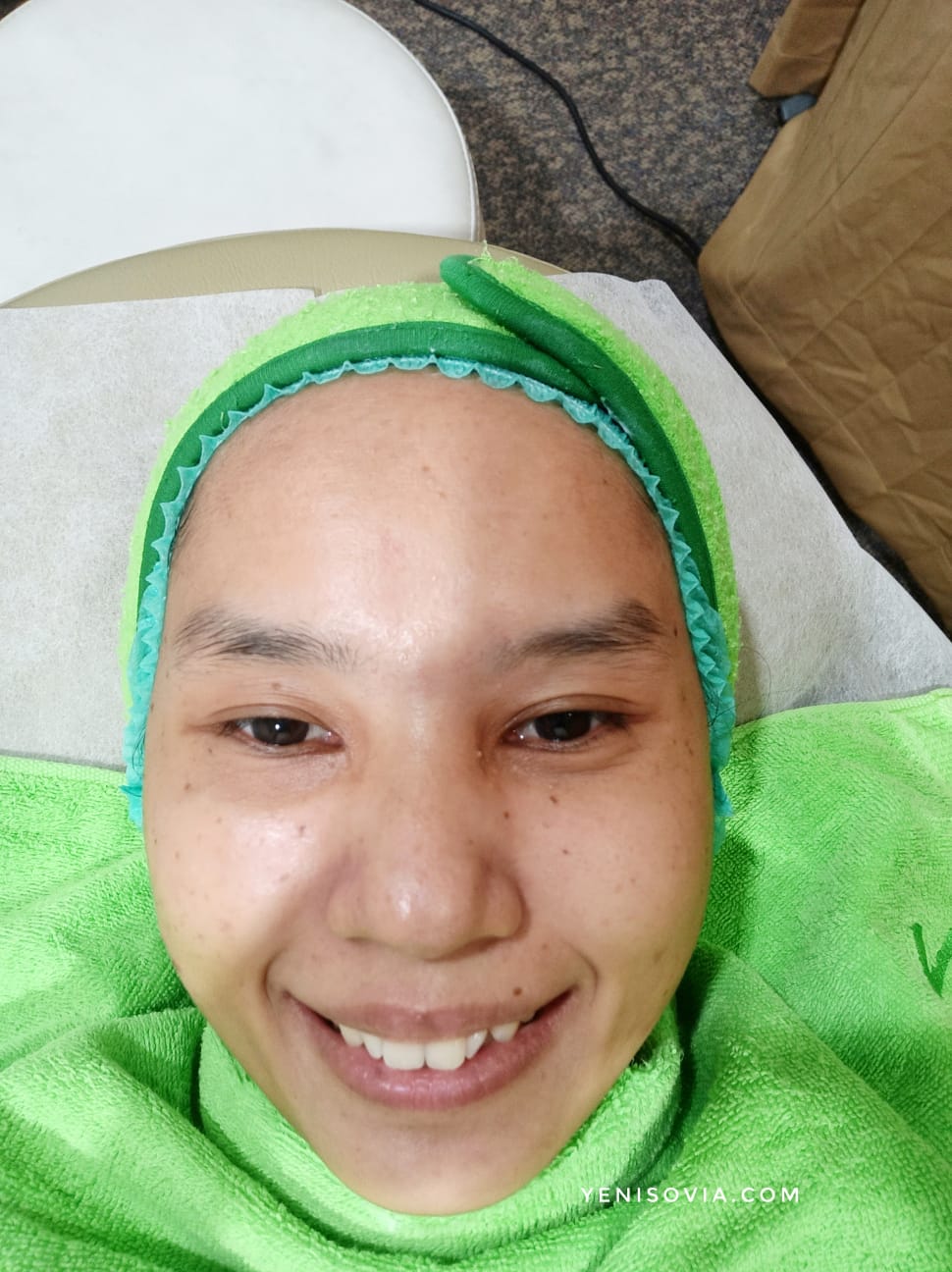 Pengalaman perawatan di ZAP Clinic Perawatan Underarms Hair Removal & Rejuvenation di ZAP Clinic