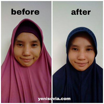 Kulit-Wajah-Bunda-Kering?-Yuk,-Intip-Pembersih-Wajah-Hada-Labo-Shirojyun-Ultimate-Whitening-Ini hasil pemakaian pembersih wajah hada labo shirojyun ultimate whitening